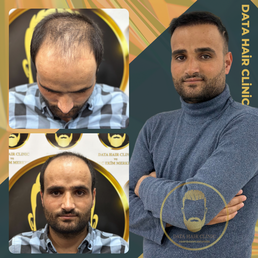 Data Hair Clinic & Eyyüp Tütüncü Saç Ekim Merkezi gallery photo