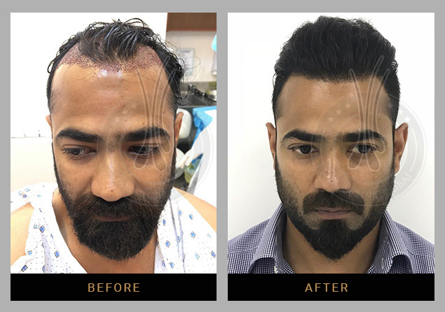Hair Clinic Dubai gallery photo