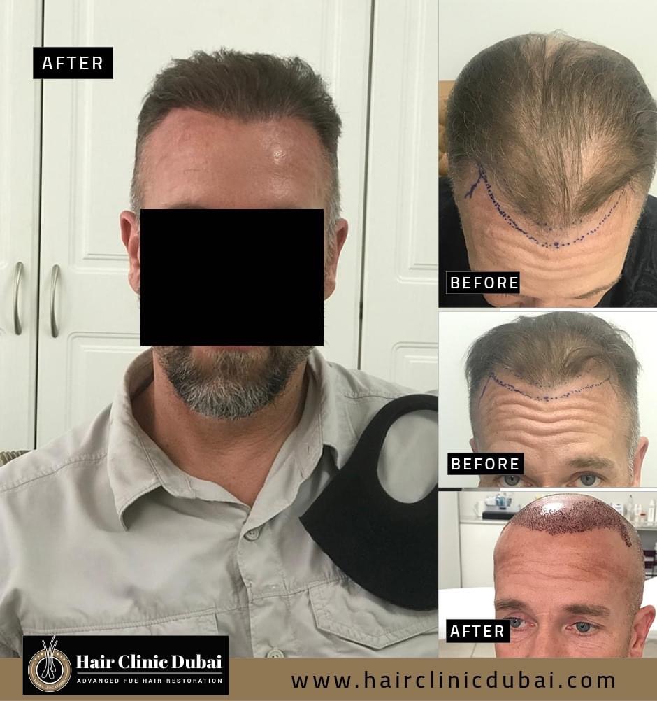 Hair Clinic Dubai gallery photo