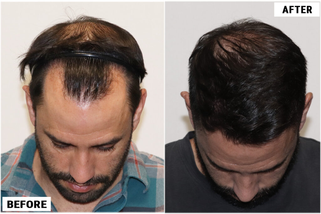 ForHair Hair Transplant Clinic — clinic photo from Google Maps