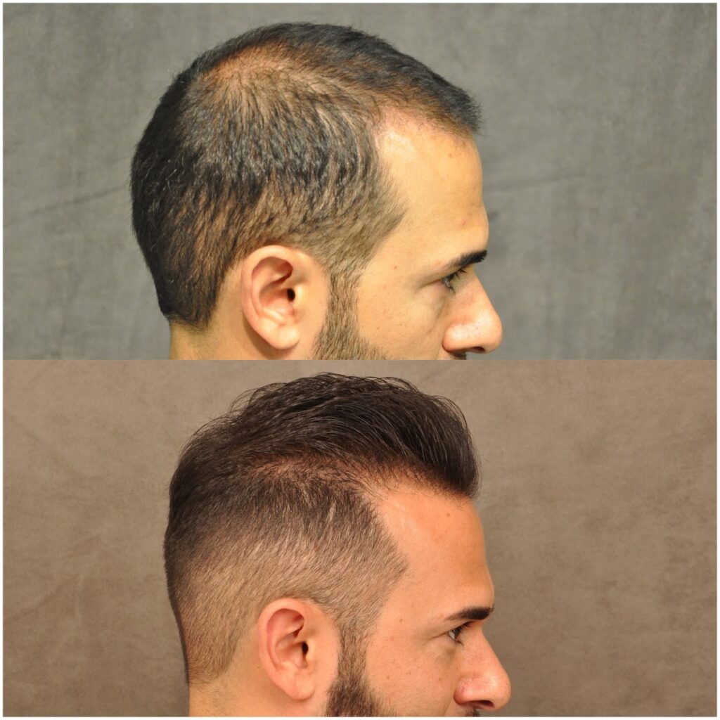 Beverly Hills Hair Group gallery photo