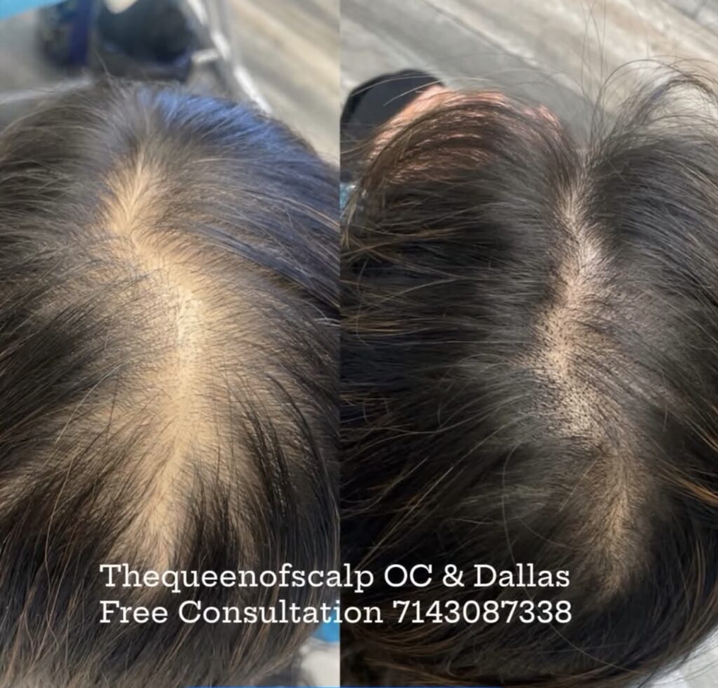 SMP Hair Clinic The Queen Of Scalp gallery photo
