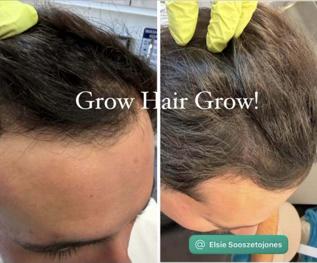 SMP Hair Clinic The Queen Of Scalp gallery photo