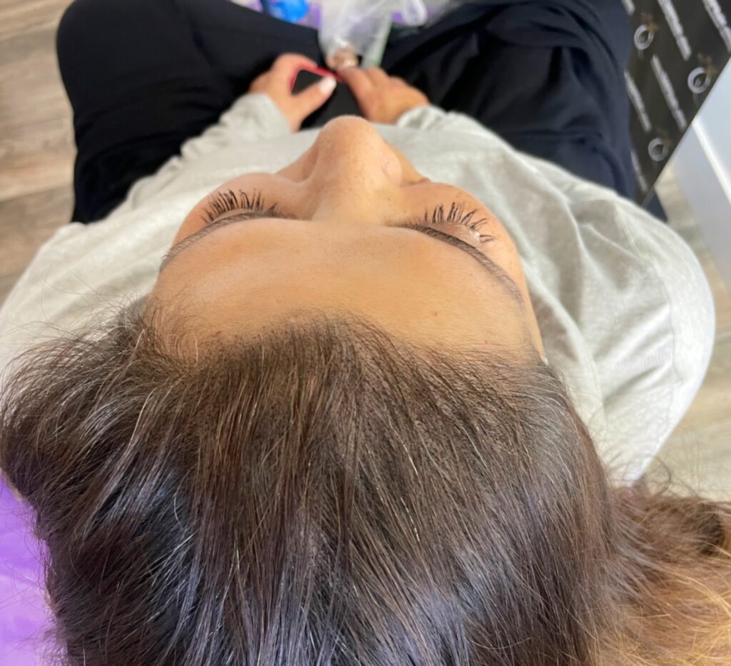 SMP Hair Clinic The Queen Of Scalp gallery photo