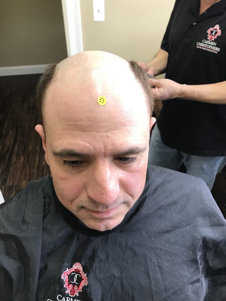 Carmen Christophers Hair Restoration gallery photo