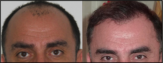 Providence Hair Restoration Center gallery photo