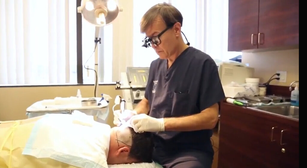 Hair Transplant San Diego: Dr. Richard Chaffoo, California Hair MD gallery photo
