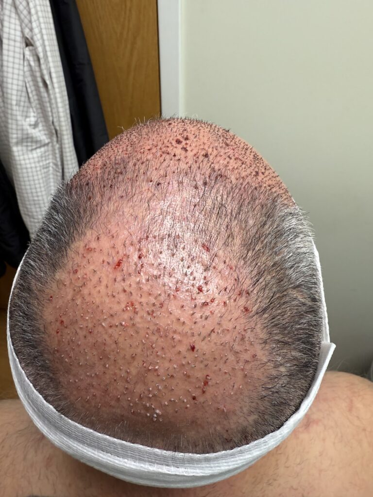Oak Brook Hair Transplant — clinic photo from Google Maps