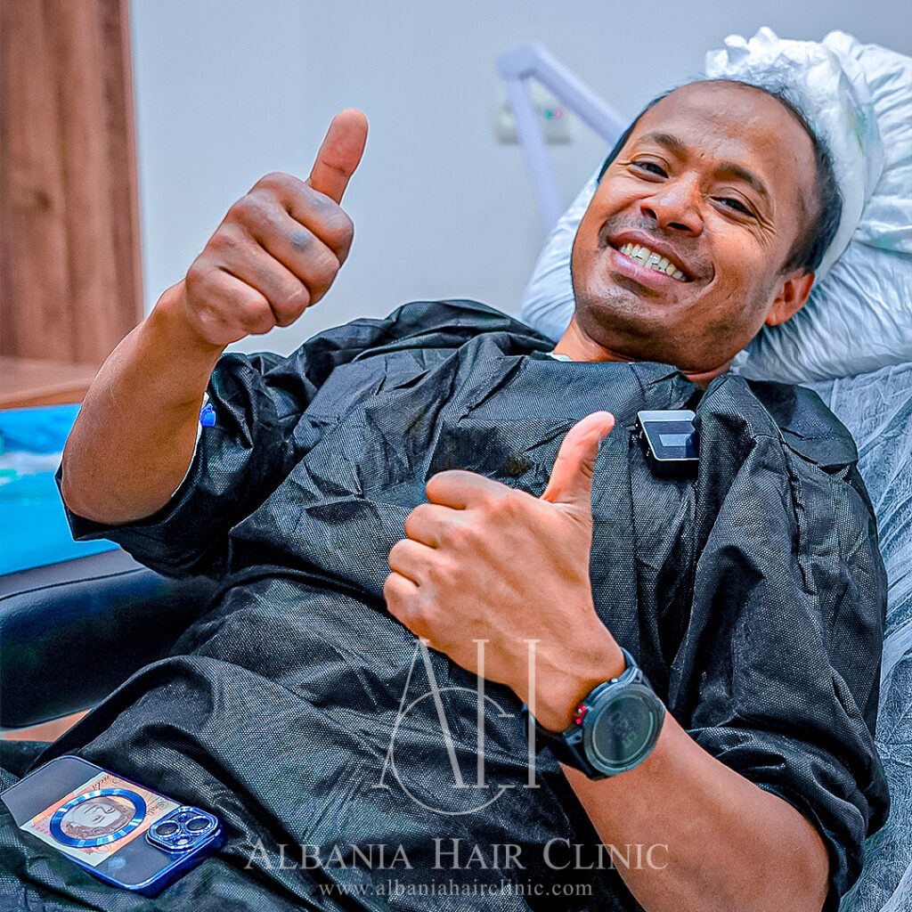 Trapianto Di Capelli | Albania Hair Clinic gallery photo