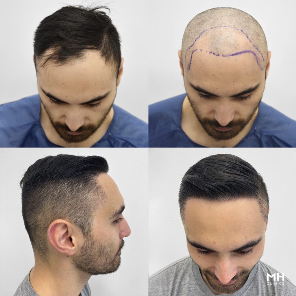 Medihair Hair Transplant Clinic — clinic photo from Google Maps