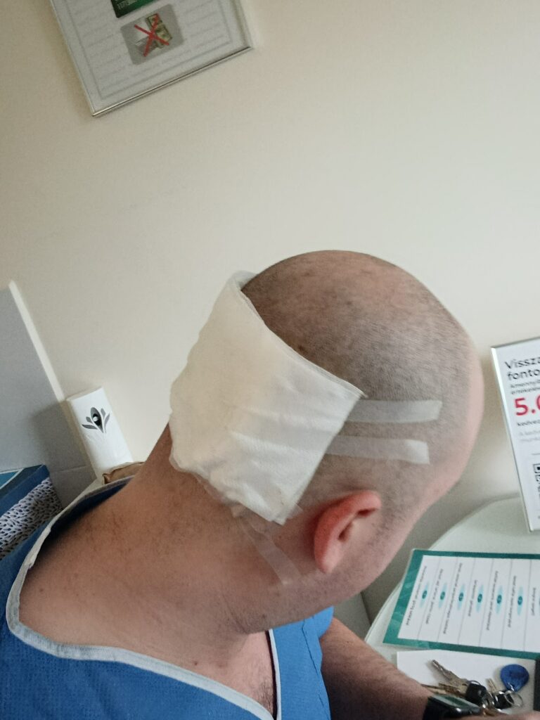 Professional Hair Implants Hair Clinic gallery photo