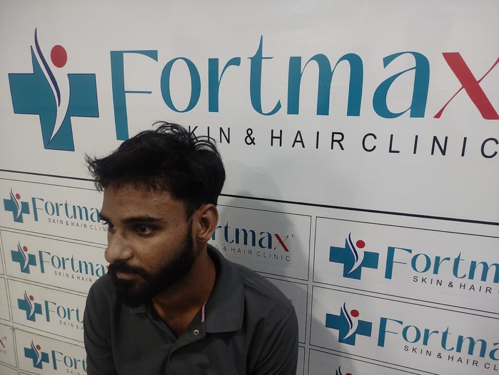 Fortmax Clinic Hair Transplant & Cosmetic Surgery in Jaipur gallery photo