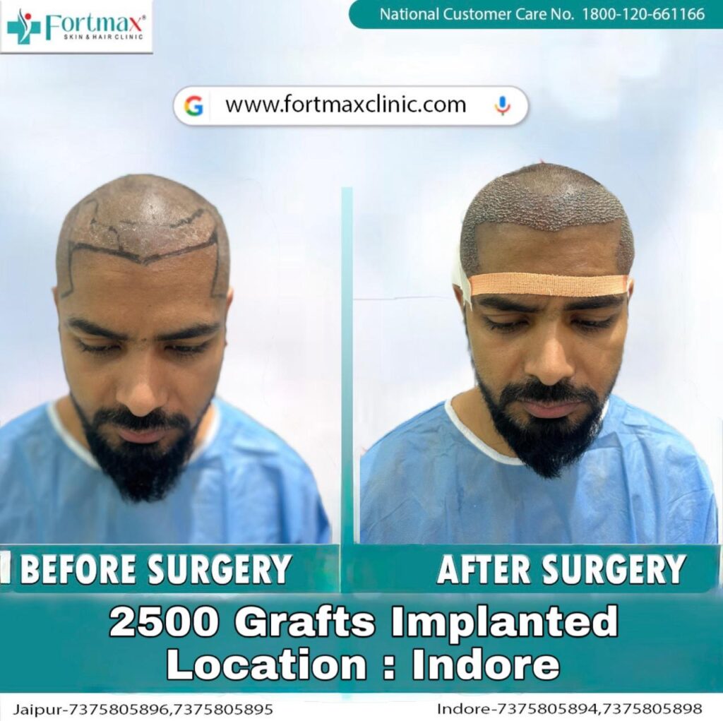 Fortmax Clinic Hair Transplant & Cosmetic Surgery in Jaipur gallery photo
