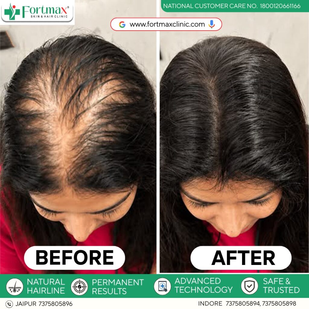 Fortmax Clinic Hair Transplant & Cosmetic Surgery in Jaipur gallery photo