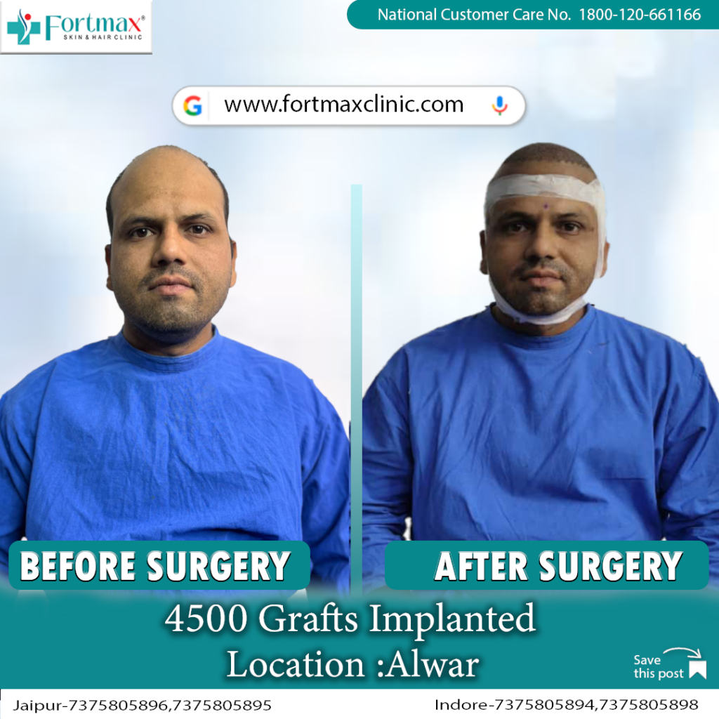 Fortmax Clinic Hair Transplant & Cosmetic Surgery in Jaipur gallery photo