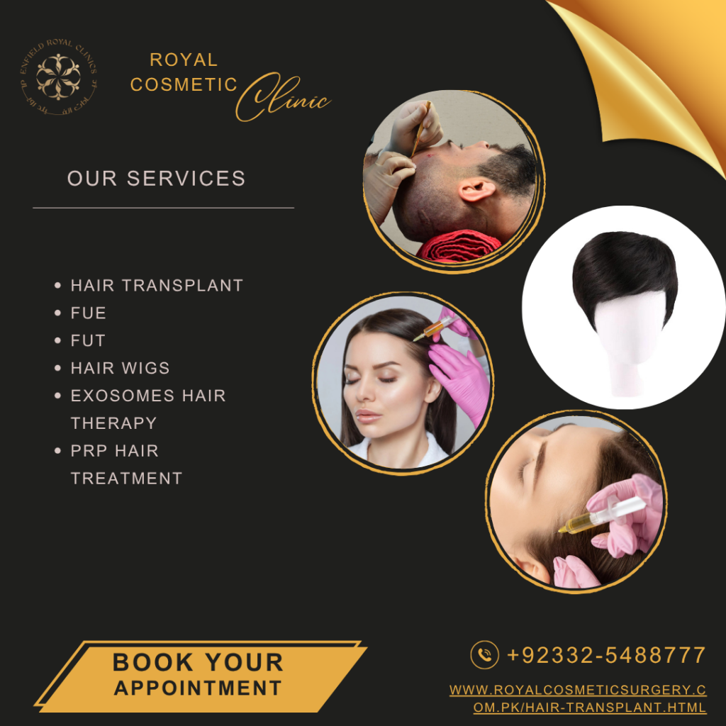 Dr Naveed Azhar – Hair Transplant in Islamabad | PRP Hair Treatment | Exosomes Therapy gallery photo