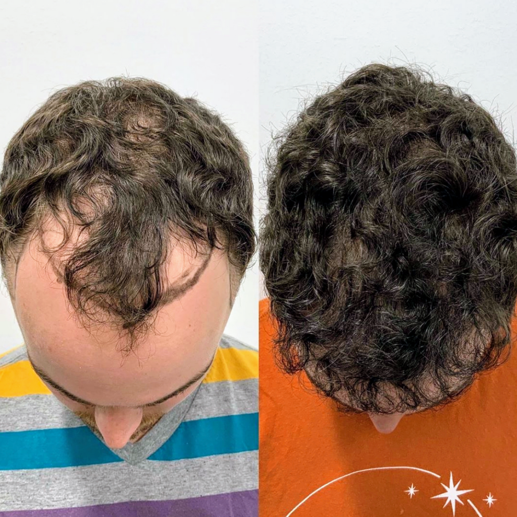 Texas Hair Restoration Center gallery photo