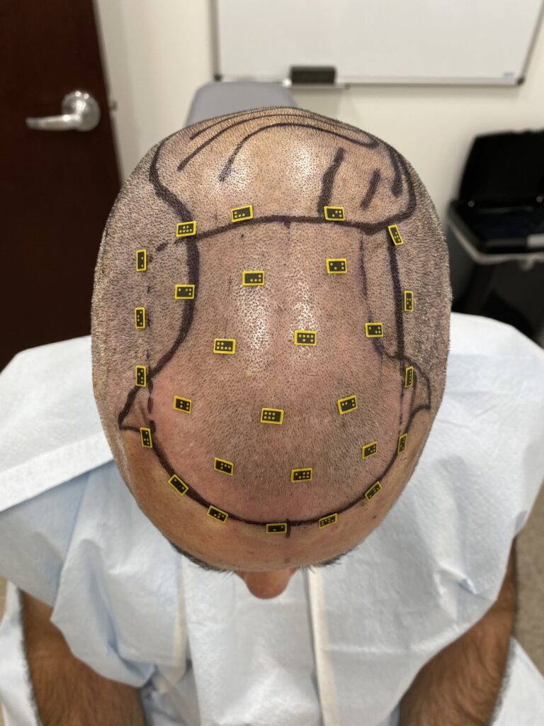 Texas Hair Restoration Center gallery photo