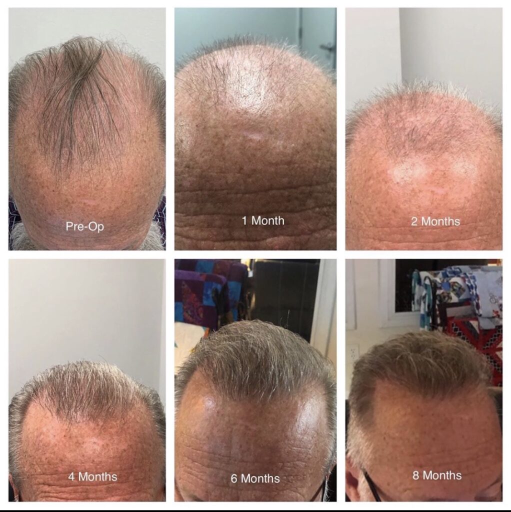 Texas Hair Restoration Center gallery photo