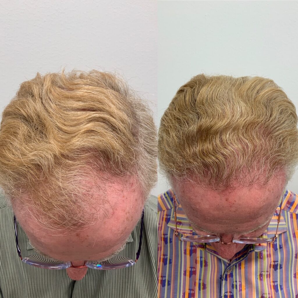 Texas Hair Restoration Center gallery photo