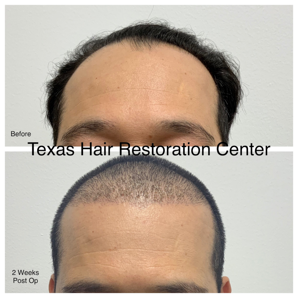 Texas Hair Restoration Center gallery photo