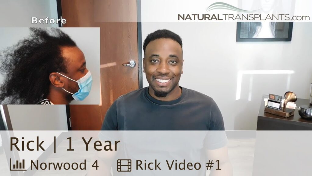 Natural Transplants, Hair Restoration Clinic gallery photo