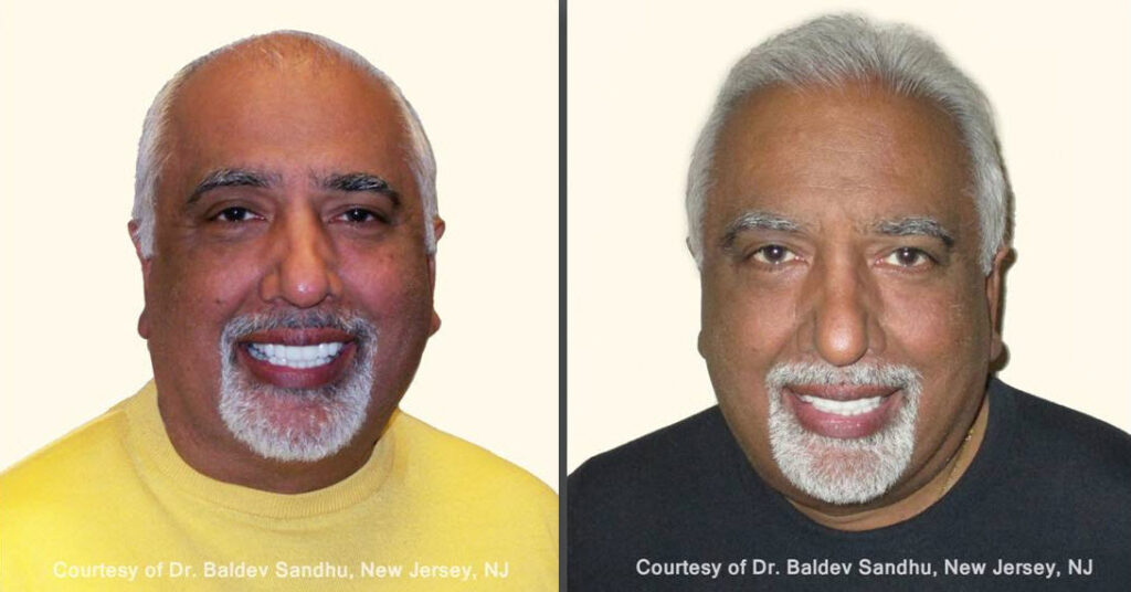 Hair Loss Treatment Center gallery photo