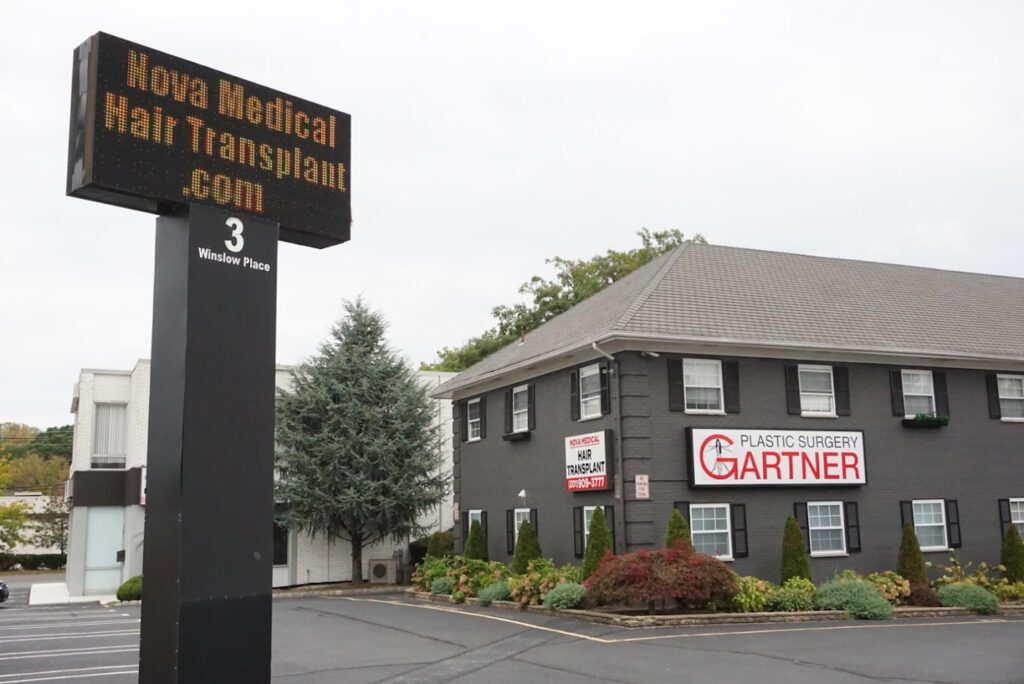New Jersey Hair Transplant | Nova Medical gallery photo