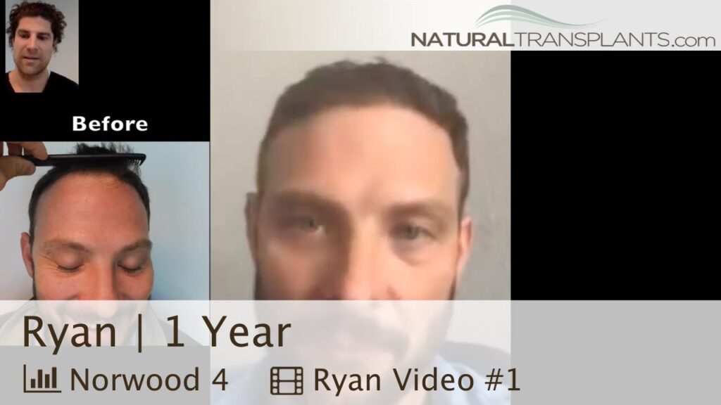 Natural Transplants, Hair Restoration Clinic gallery photo