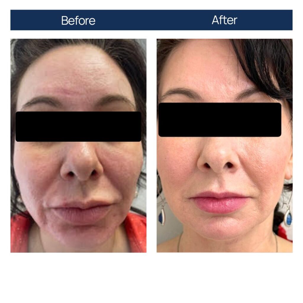 Reviva Hair & Skin Clinic gallery photo