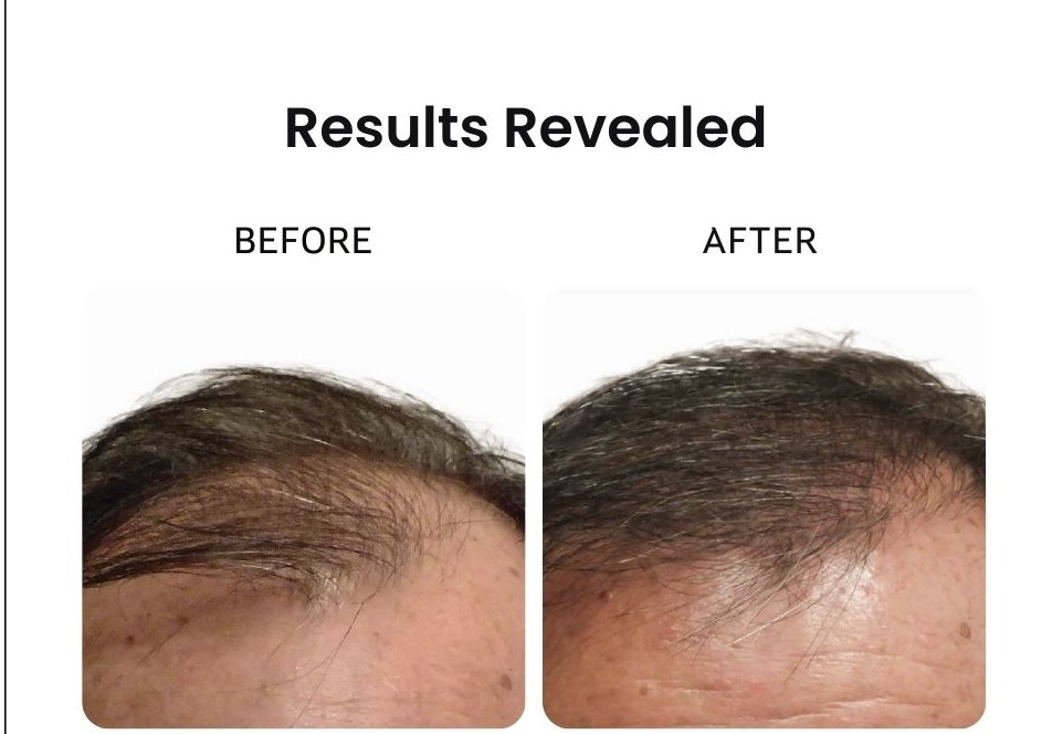 Reviva Hair & Skin Clinic gallery photo