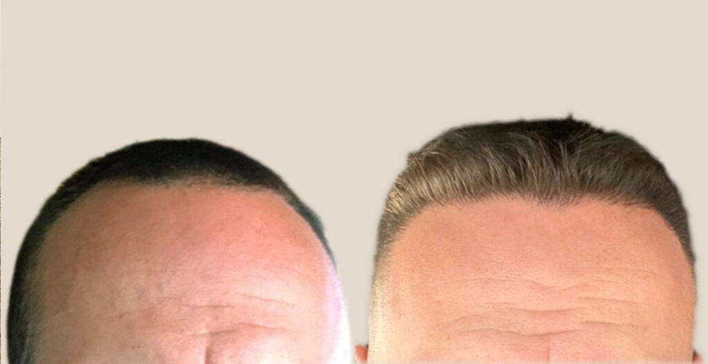 Louisville Hair Doctor gallery photo