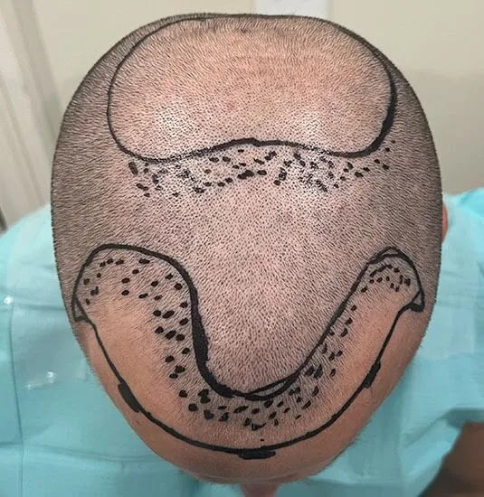 Louisville Hair Doctor gallery photo