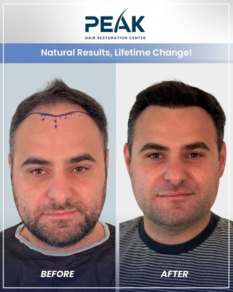 Peak Hair Restoration & Transplant Center- New York City — clinic photo from Google Maps