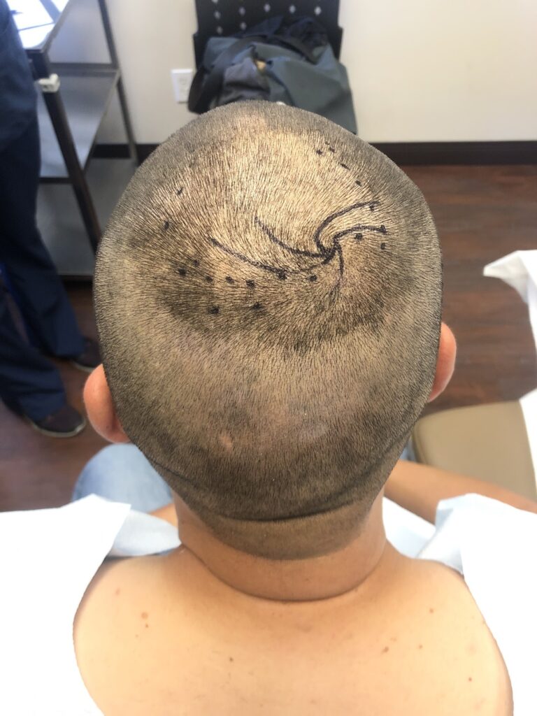 Concord Hair Restoration — clinic photo from Google Maps