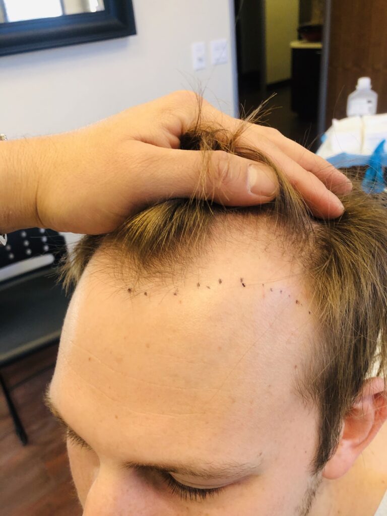 Concord Hair Restoration gallery photo