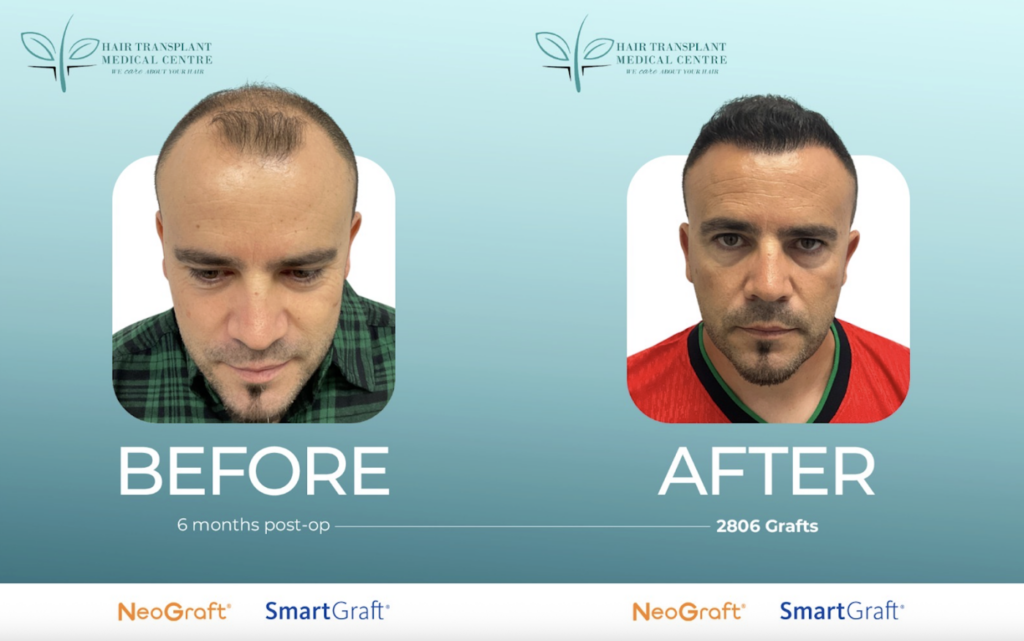 Hair Transplant Medical Centre Mississauga & Toronto | Hair Loss Treatment — clinic photo from Google Maps