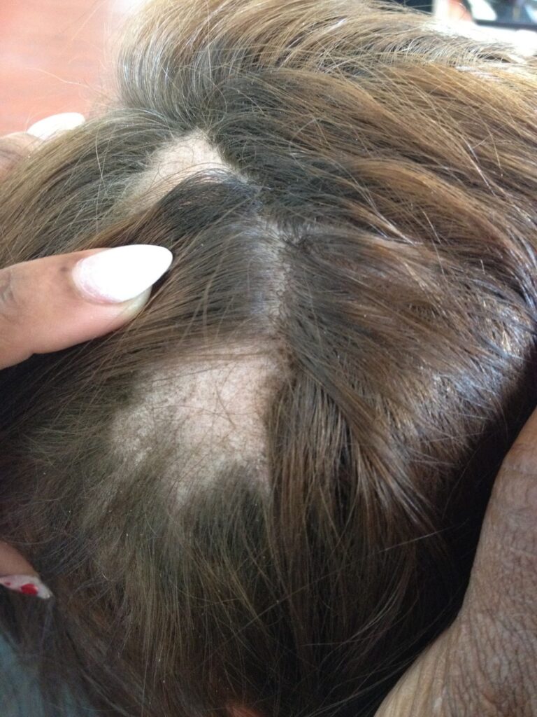 Pacific Hair Loss Solutions gallery photo
