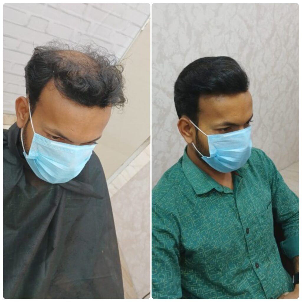 Advance Hair Clinic gallery photo