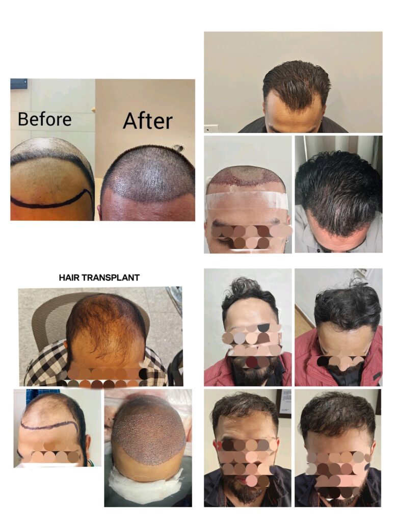 Dr. Kaushik’s Novena Clinic | Hair Transplant & Plastic Surgery in Chandigarh gallery photo