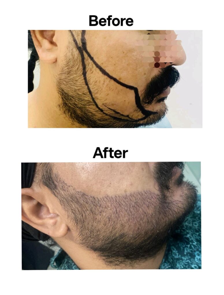 Dr. Kaushik’s Novena Clinic | Hair Transplant & Plastic Surgery in Chandigarh gallery photo
