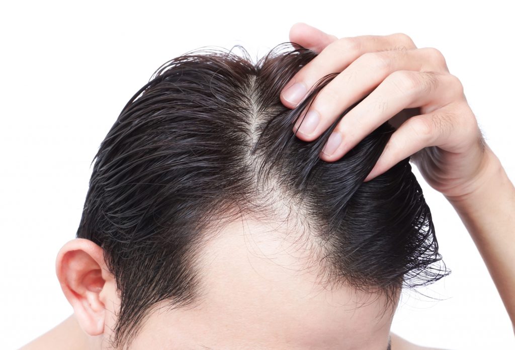Crown- The Hair Transplant Experts gallery photo