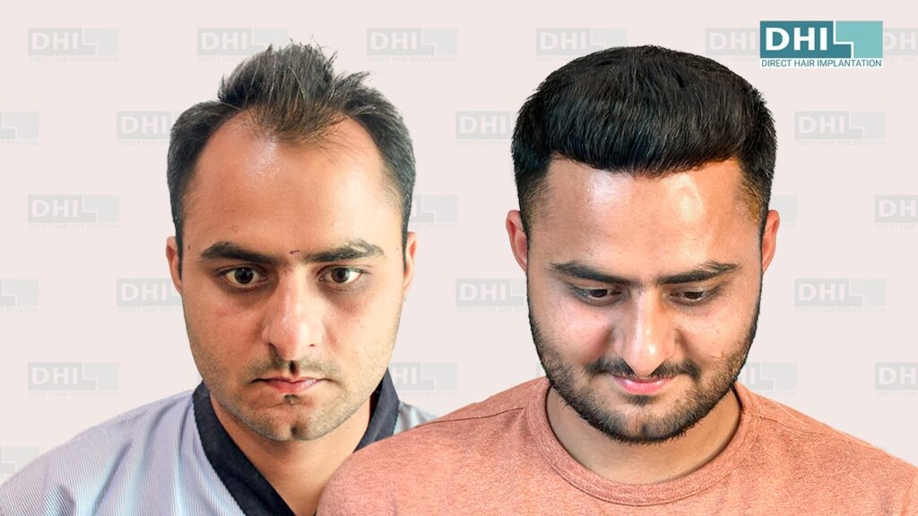 DHI Hair Restoration Clinic — clinic photo from Google Maps