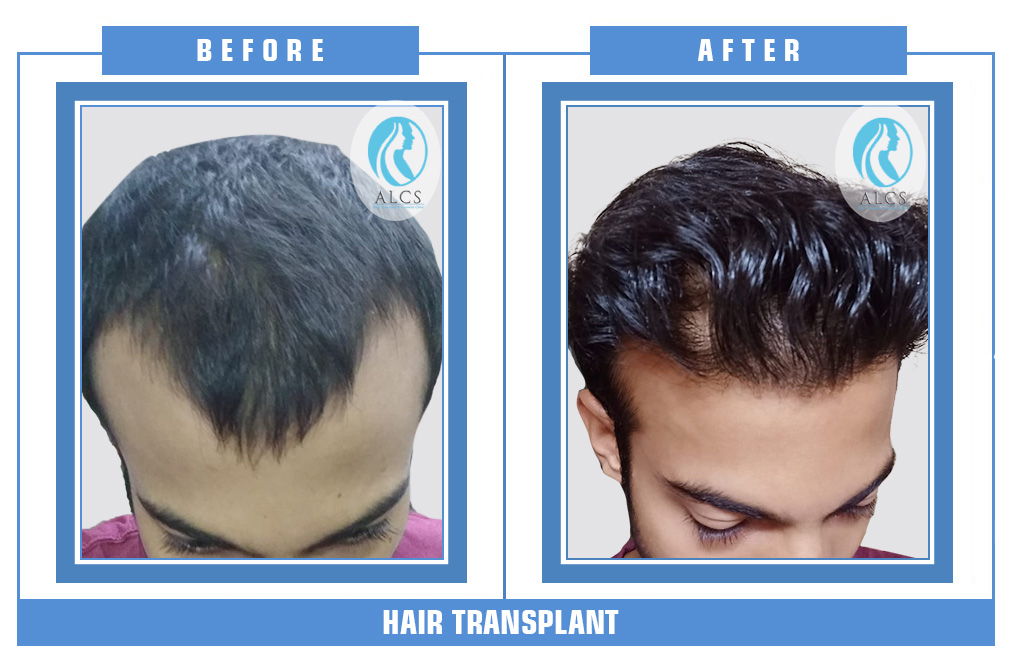 ALCS Hair Transplant and Cosmetic Clinic — clinic photo from Google Maps