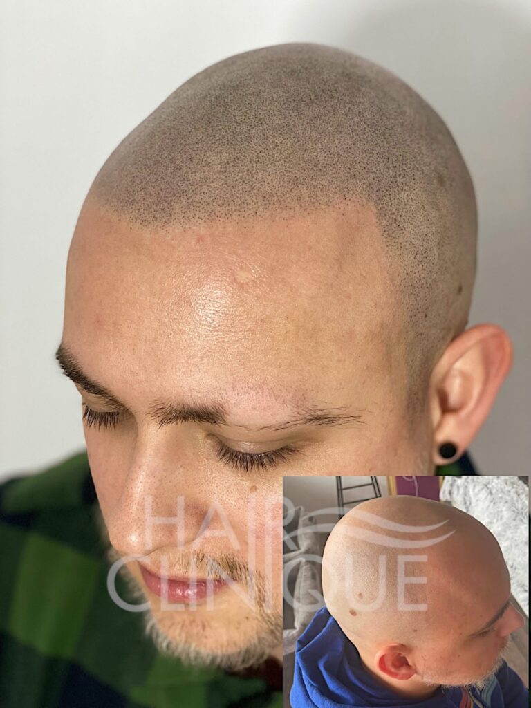 HAIR CLINIQUE gallery photo