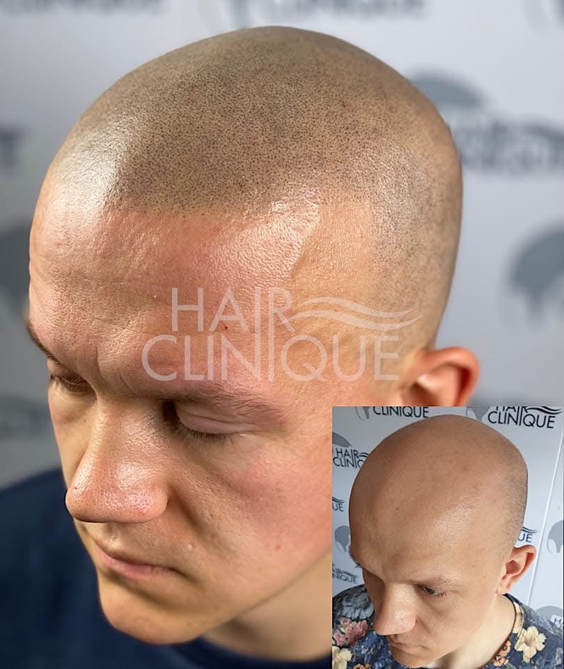 HAIR CLINIQUE gallery photo