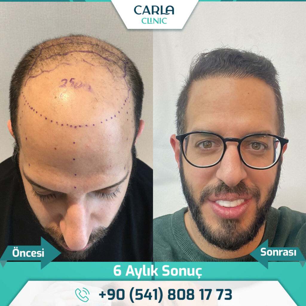 Odio Clinic – Cidde Hair Transplant Center — clinic photo from Google Maps
