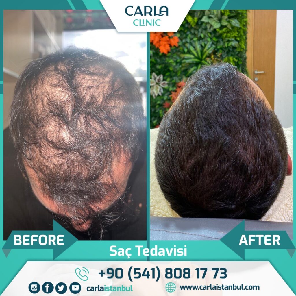 Odio Clinic – Cidde Hair Transplant Center gallery photo