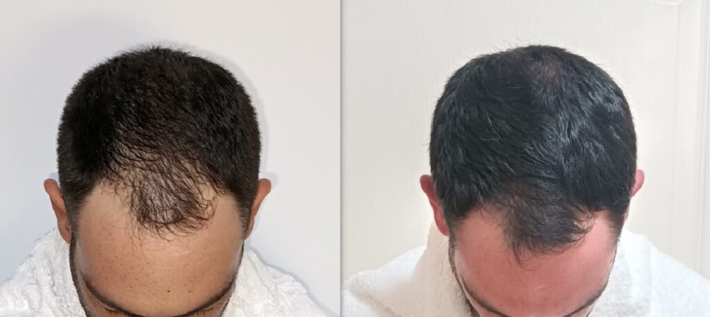 Dr Alexander’s Hair Loss Clinic gallery photo