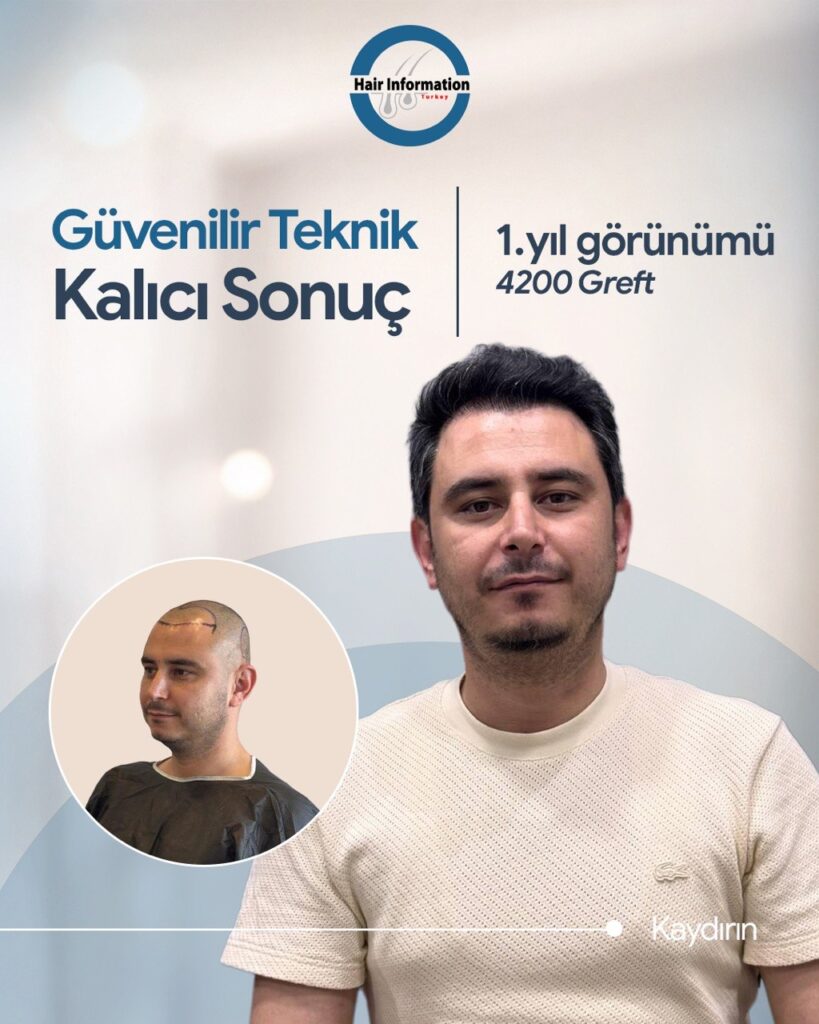 Hair Information Clinic – Saç Ekimi gallery photo